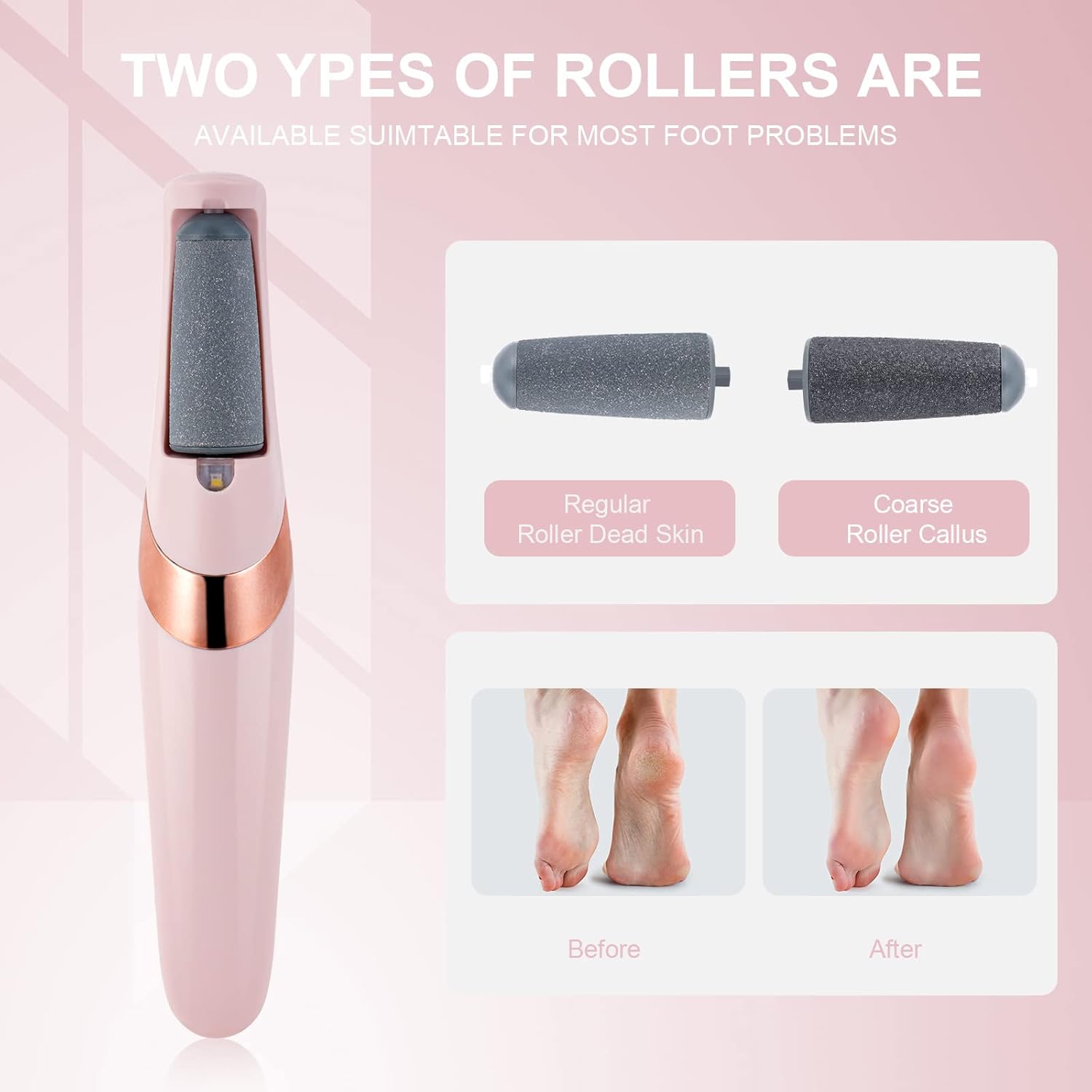 Rechargeable Electric Foot File | Callus & Dead Skin Remover with LED Light