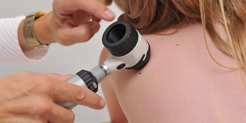 Dermatoscope – German Stainless Steel Handheld Dermoscopy Instrument for Skin Lesion Examination